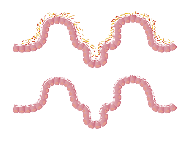 腸内フローラと大腸のイラスト